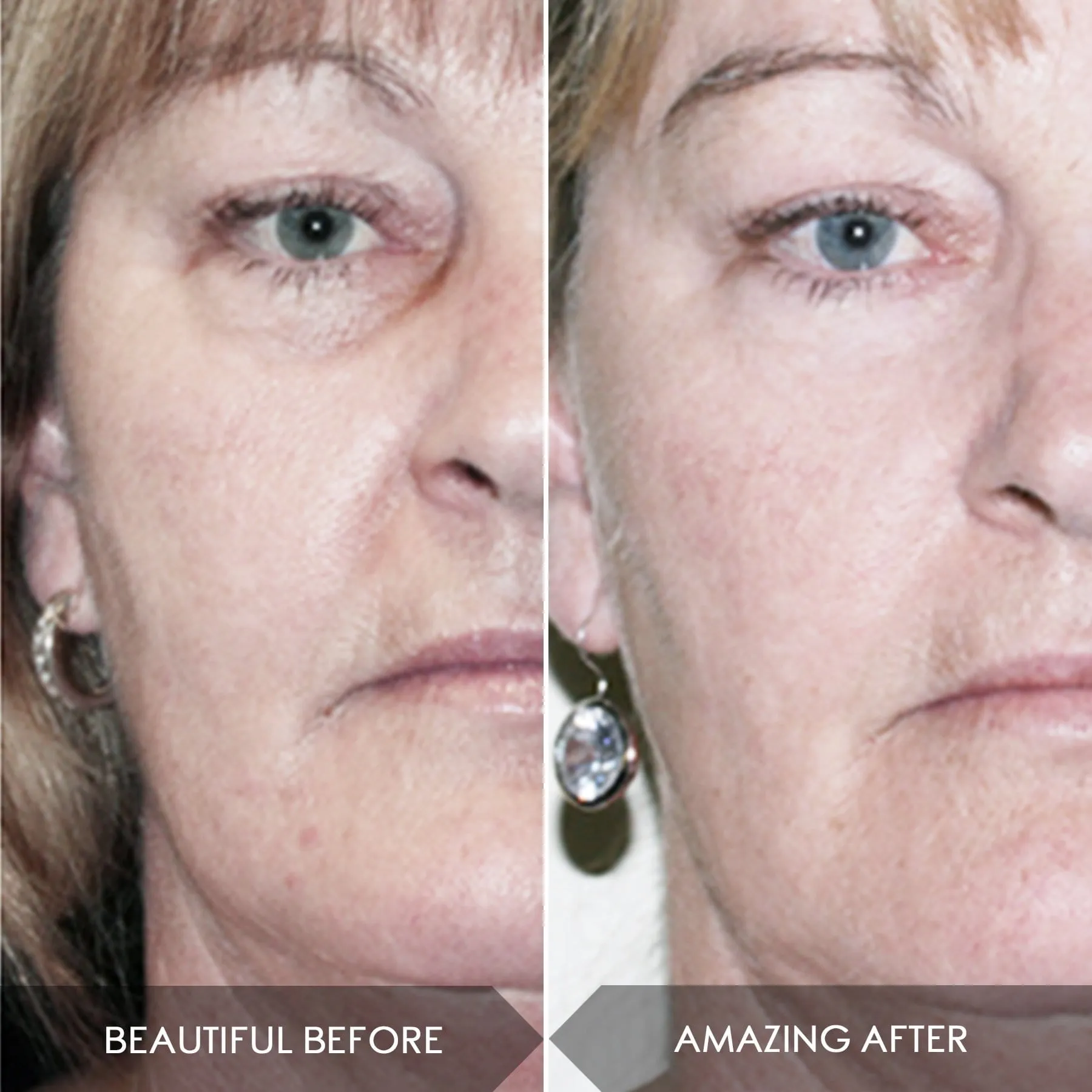 Midnight Magic Cell Serum With 100% Actives Mini   Free Mini With Niacinamide
